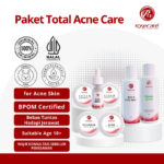 PAKET TOTAL ACNE CARE ROSECARE BPOM HALAL SKINCARE KRIM MENGILANGKAN ROSASEA JERAWAT CREAM KOMEDO