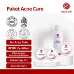 PAKET ACNE CARE REMAJA ROSECARE SKINCARE CREAM WAJAH KRIM PERAWATAN UNTUK KULIT JERAWAT BRUNTUSAN REMAJA PELAJAR MULAI USIA 13TH